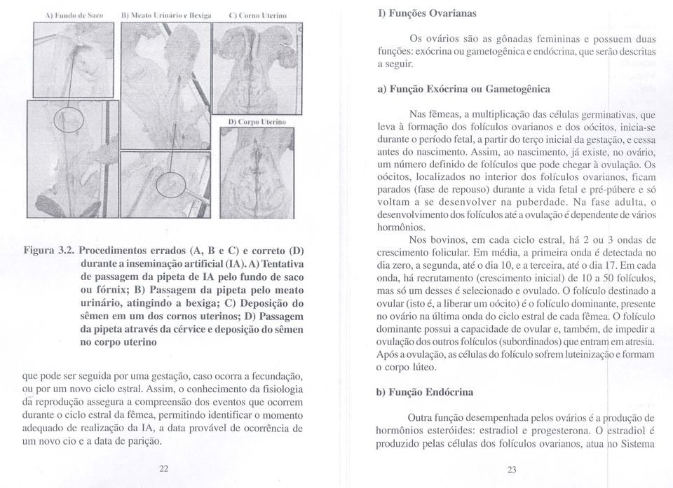 A) Tentativa de passagem da pipeta de IA pelo fundo de saco ou fórnix; B) Pas~agem da pipeta pelo meato urinário, atingindo a bexiga; C) Deposição do sêmen em um dos cornos uterinos; D) Passagem da