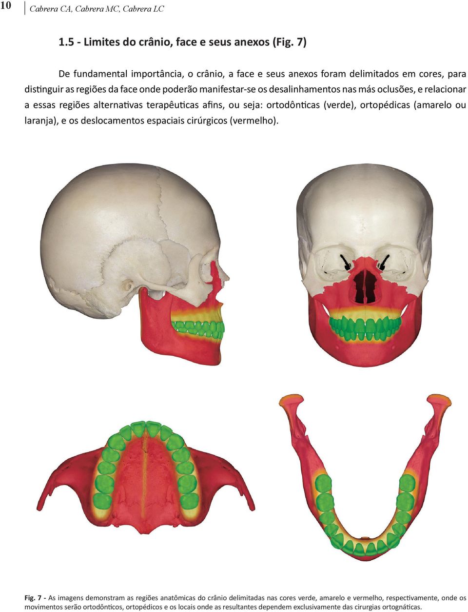 oclusões, e relacionar a essas regiões alternativas terapêuticas afins, ou seja: ortodônticas (verde), ortopédicas (amarelo ou laranja), e os deslocamentos espaciais cirúrgicos