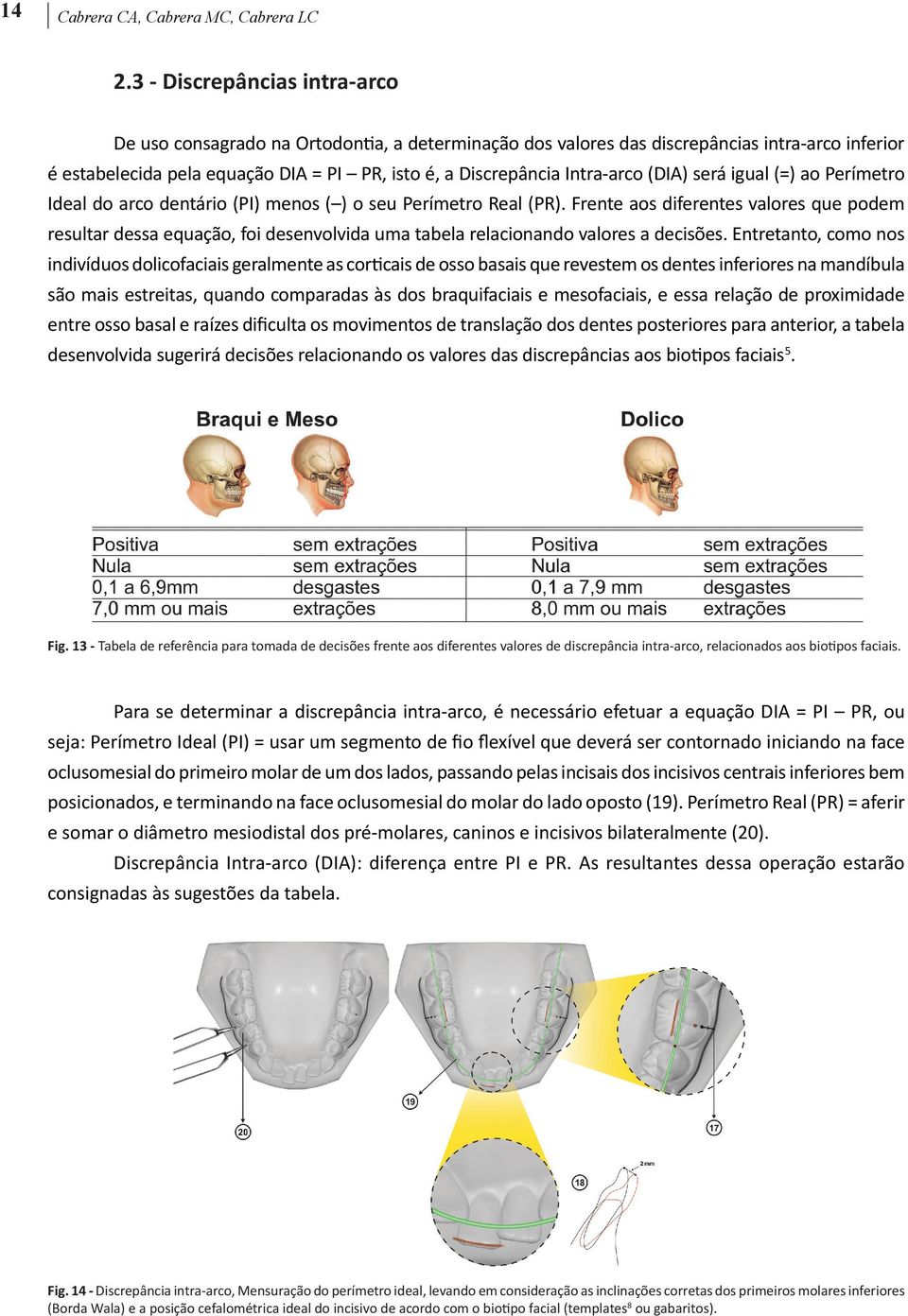 Intra-arco (DIA) será igual (=) ao Perímetro Ideal do arco dentário (PI) menos ( ) o seu Perímetro Real (PR).