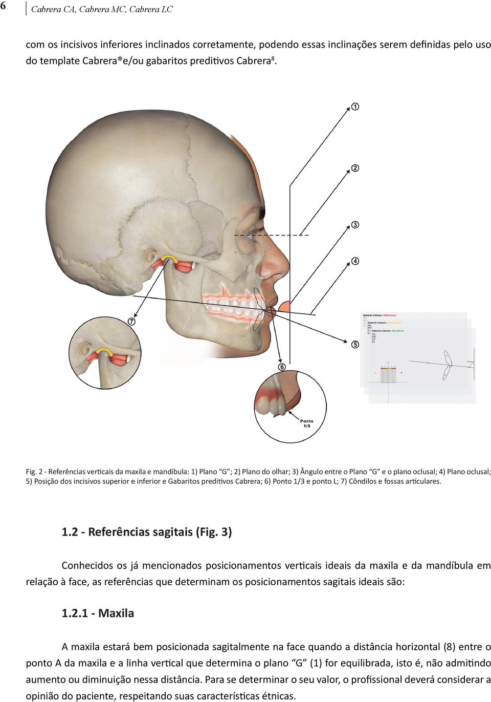 Gabaritos preditivos Cabrera; 6) Ponto 1/3 e ponto L; 7) Côndilos e fossas articulares. 1.2 - Referências sagitais (Fig.