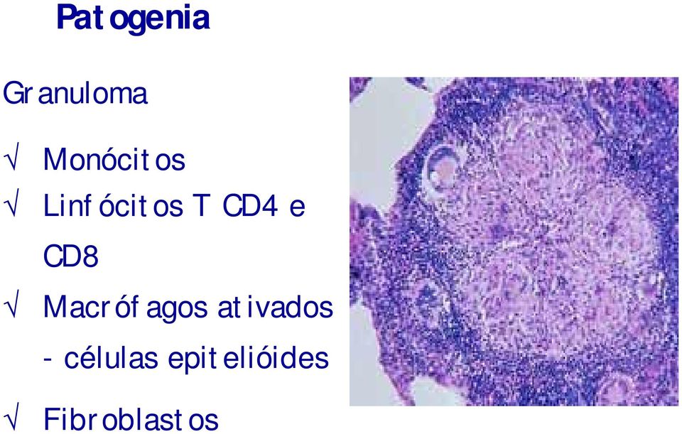 e CD8 Macrófagos ativados
