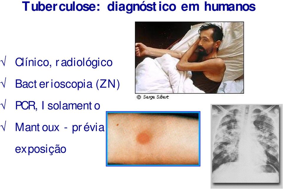 Bacterioscopia (ZN) PCR,