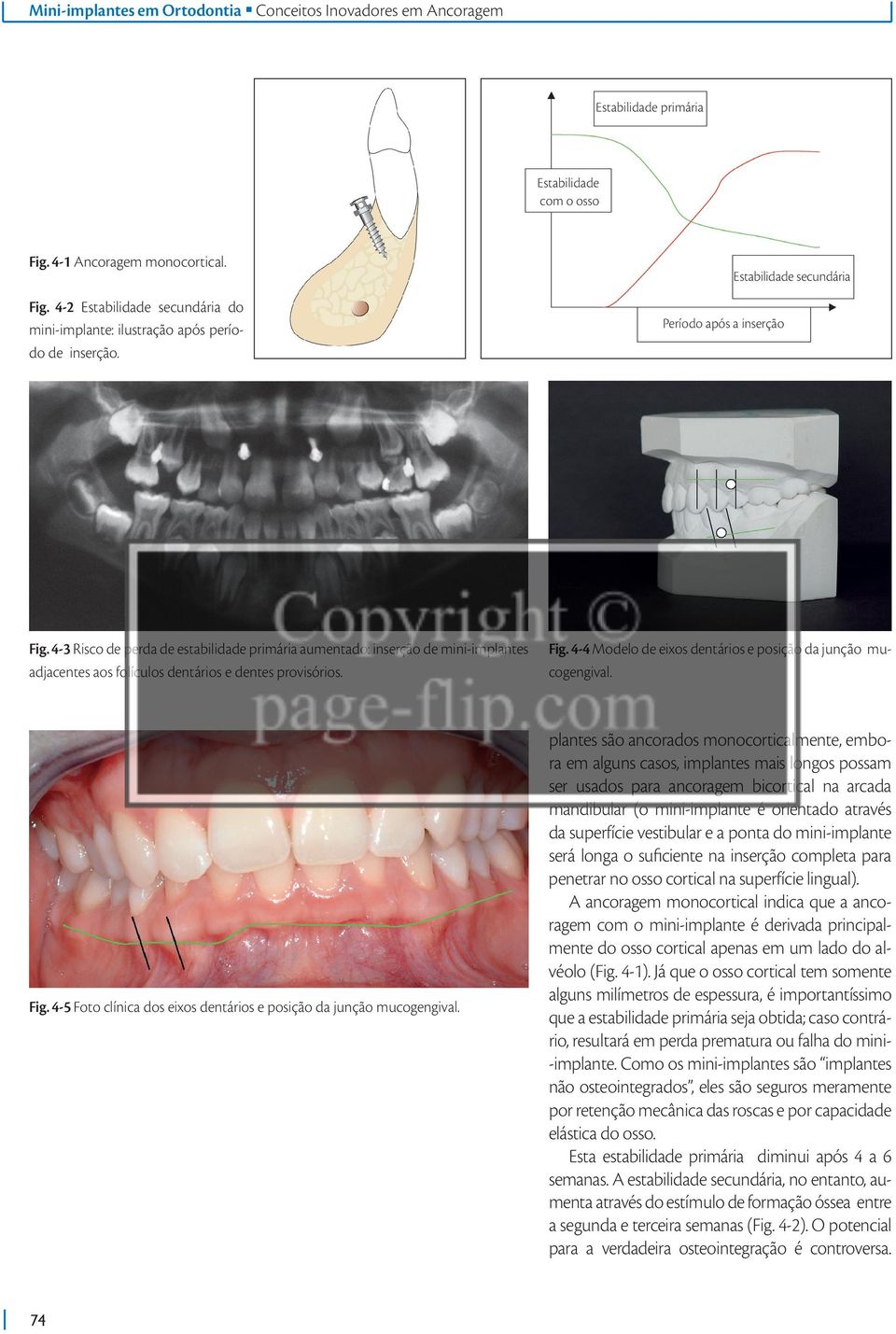 Fig. 4-5 Foto clínica dos eixos dentários e posição da junção mucogengival.