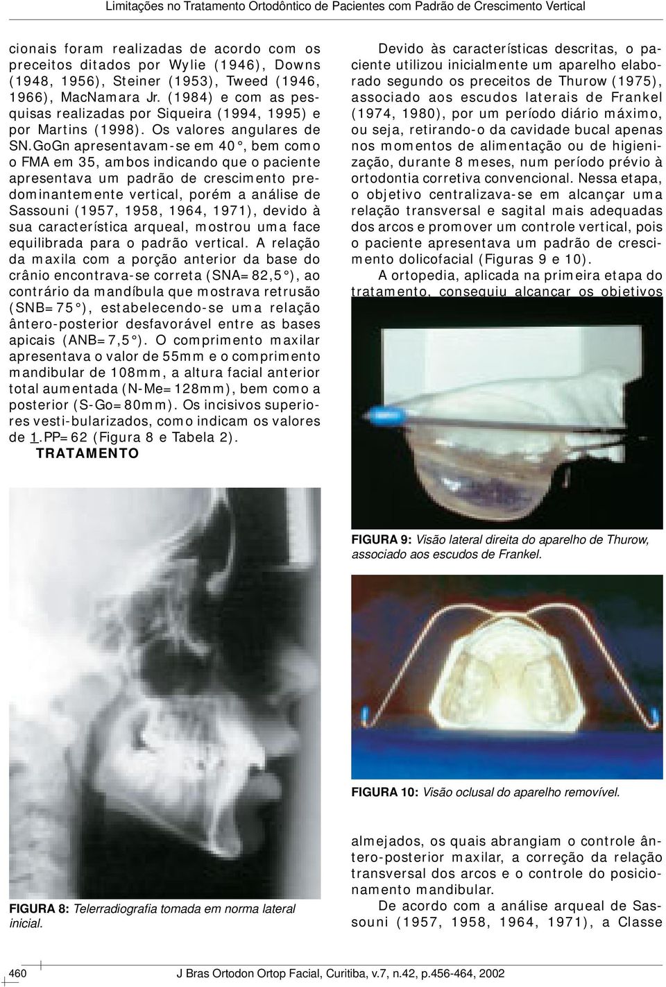 GoGn apresentavam-se em 40, bem como o FMA em 35, ambos indicando que o paciente apresentava um padrão de crescimento predominantemente vertical, porém a análise de Sassouni (1957, 1958, 1964, 1971),