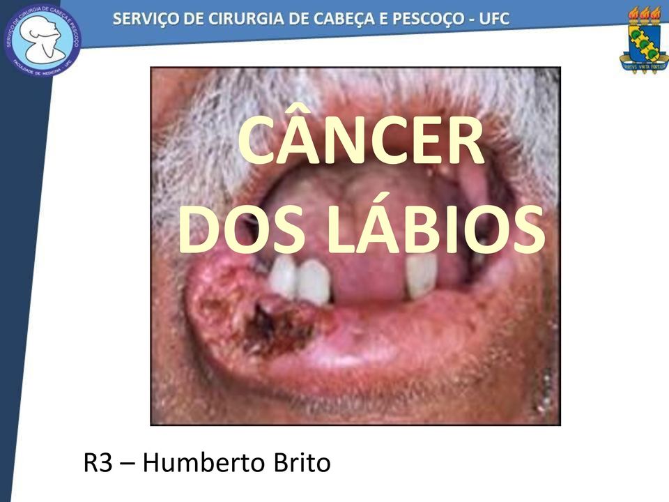 LÁBIOS R3