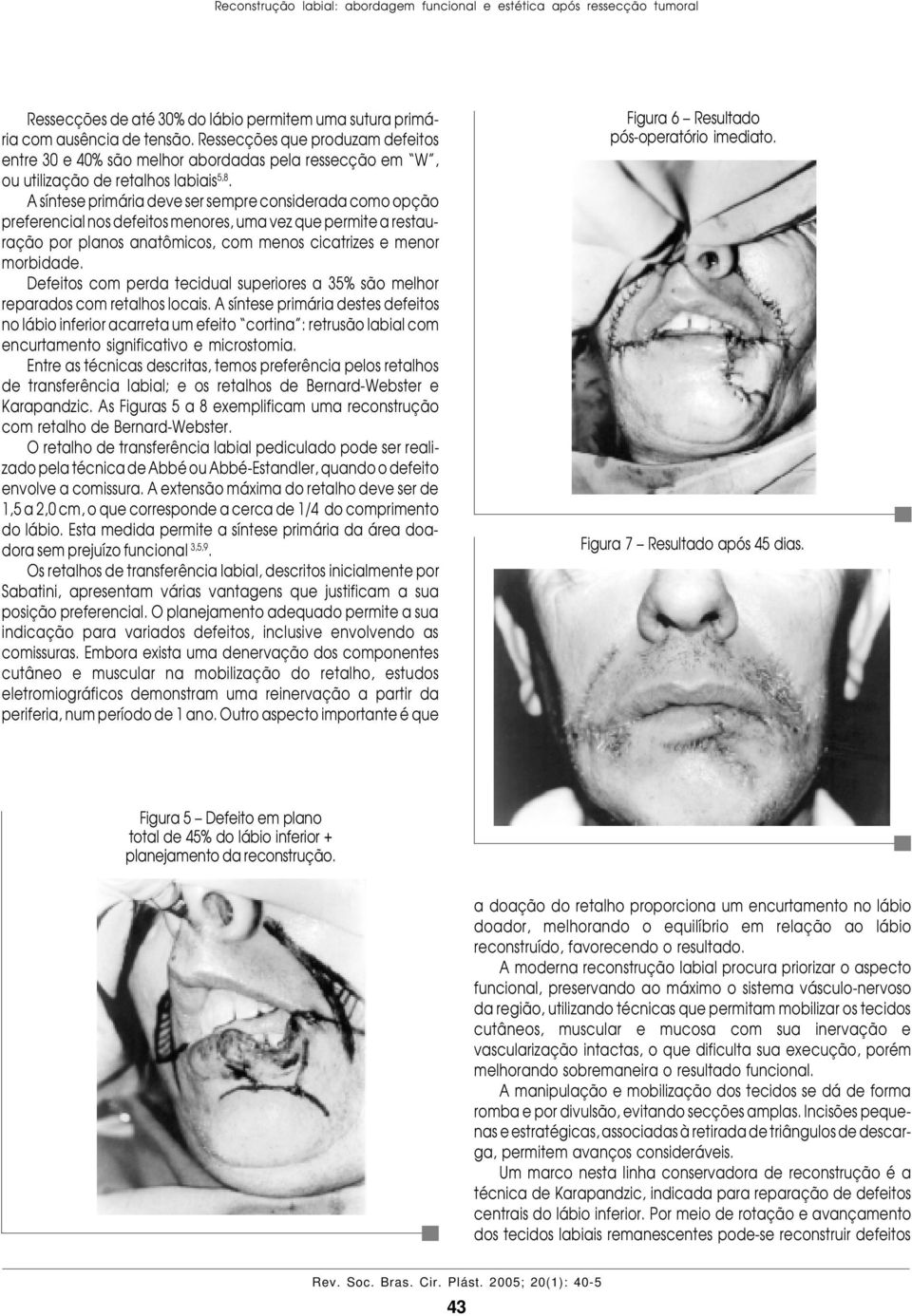 A síntese primária deve ser sempre considerada como opção preferencial nos defeitos menores, uma vez que permite a restauração por planos anatômicos, com menos cicatrizes e menor morbidade.