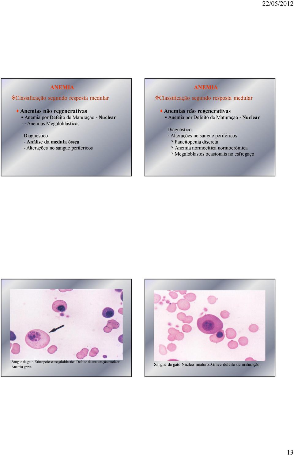 sangue periféricos Pancitopenia discreta Anemia normocítica normocrômica Megaloblastos ocasionais no esfregaço Sangue de gato.