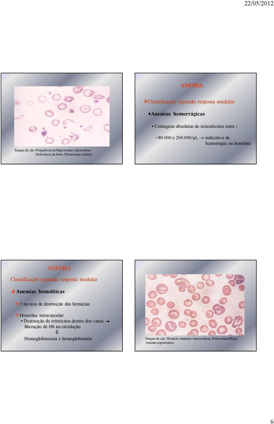 000/µL indicativo de hemorragia ou hemólise Classificação segundo resposta medular Anemias hemolíticas na taxa de destruição das