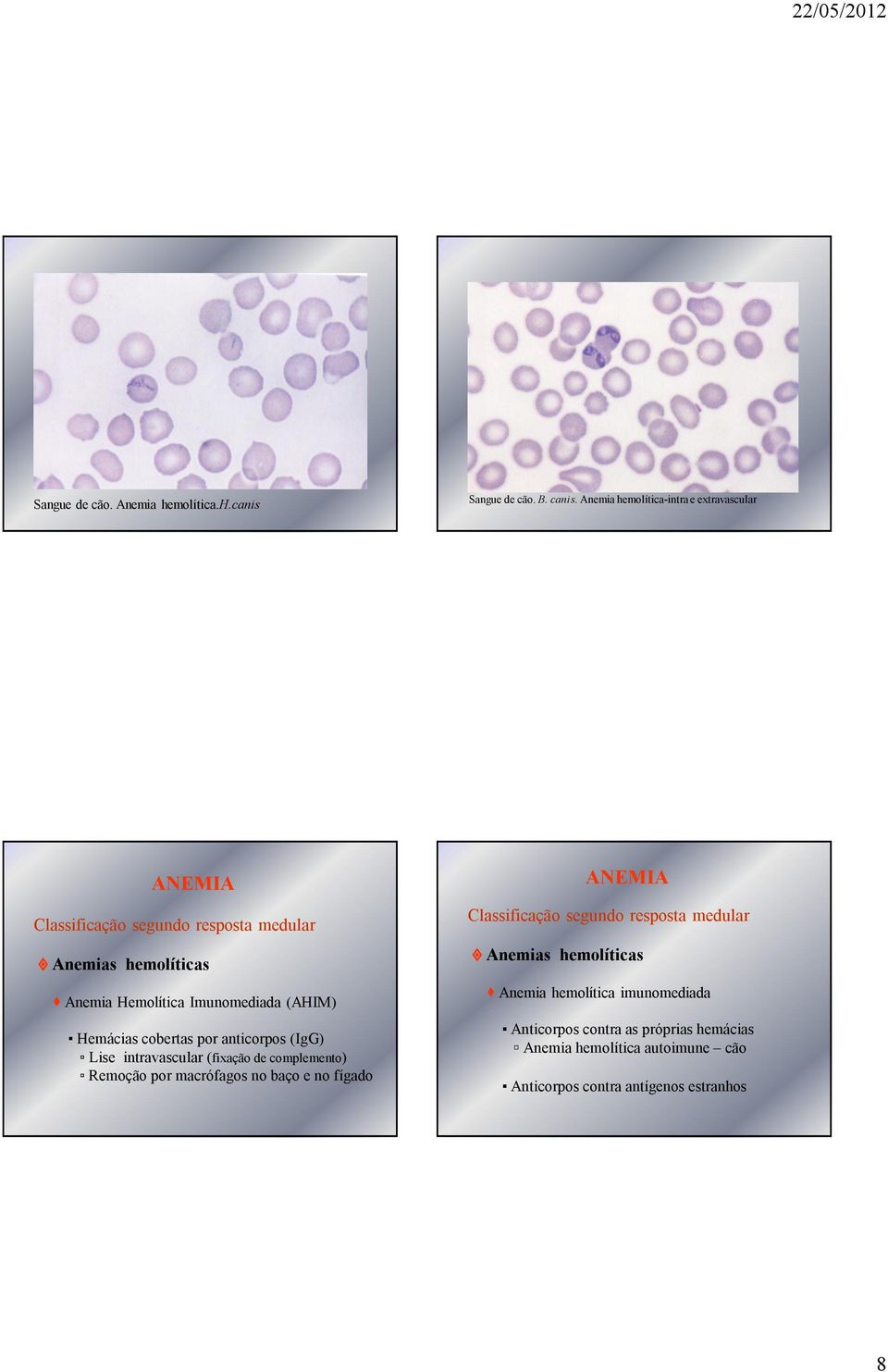 (AHIM) Hemácias cobertas por anticorpos (IgG) Lise intravascular (fixação de complemento) Remoção por macrófagos no baço e no fígado