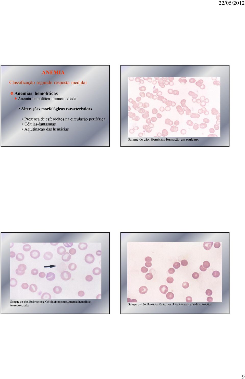 Aglutinação das hemácias Sangue de cão. Hemácias formação em rouleaux Sangue de cão. Esferocitose.