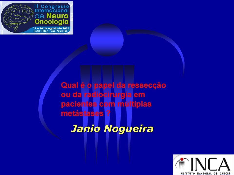 radiocirurgia em