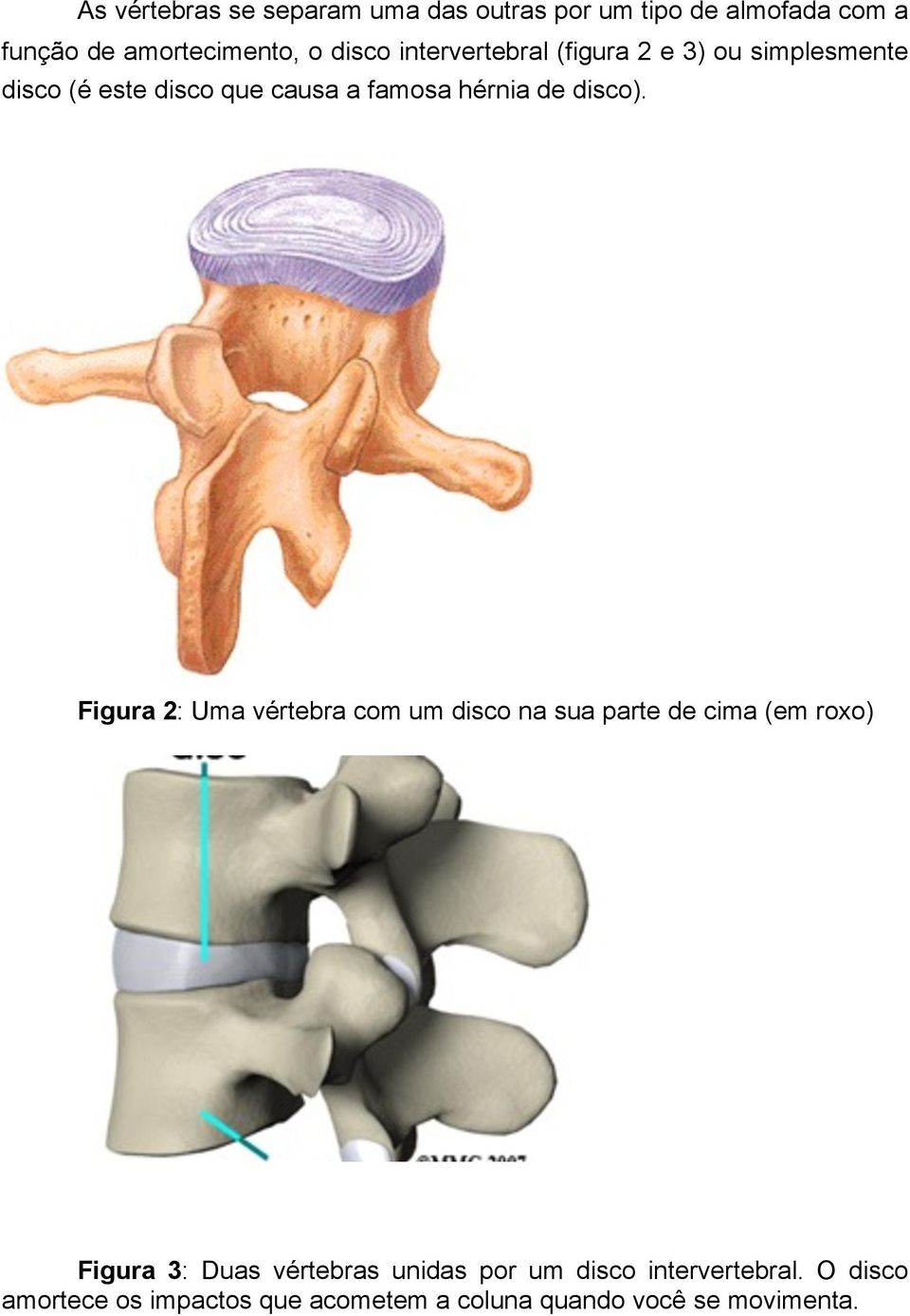 Figura 2: Uma vértebra com um disco na sua parte de cima (em roxo) Figura 3: Duas vértebras unidas por