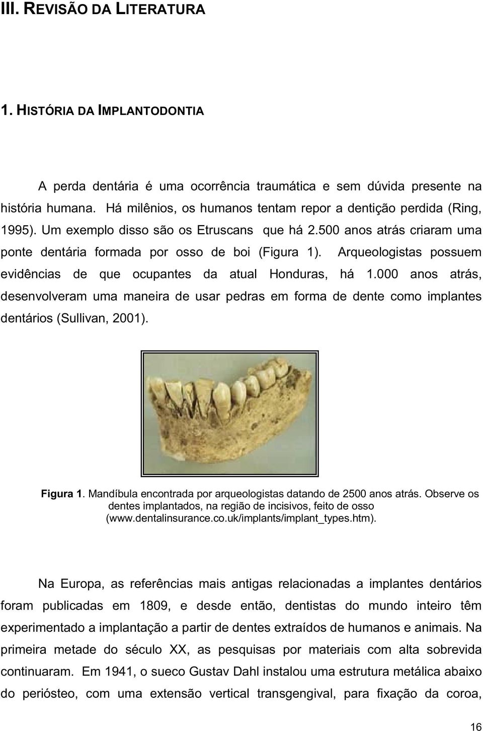Arqueologistas possuem evidências de que ocupantes da atual Honduras, há 1.000 anos atrás, desenvolveram uma maneira de usar pedras em forma de dente como implantes dentários (Sullivan, 2001).
