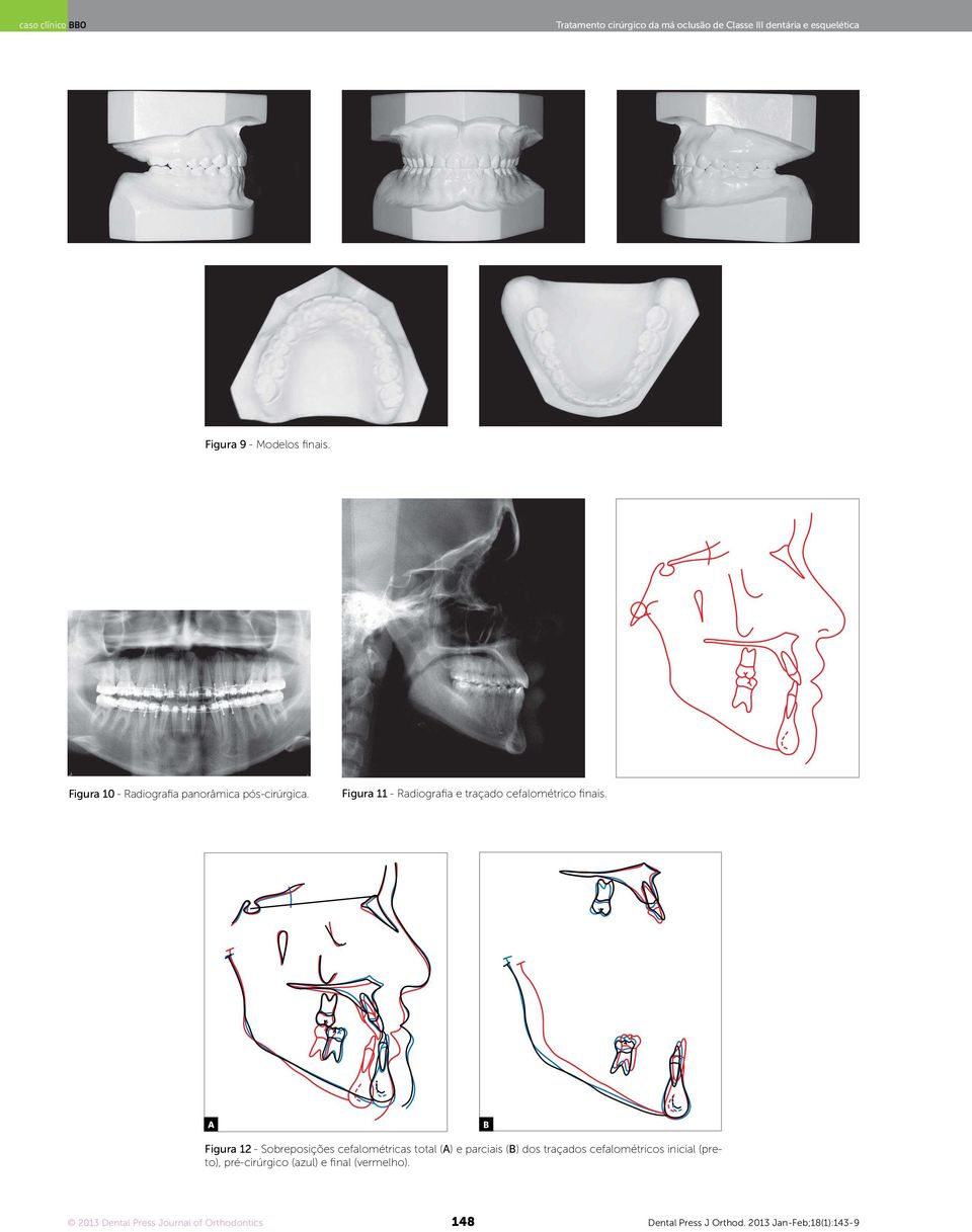 Figura 11 - Radiograia e traçado cefalométrico inais.