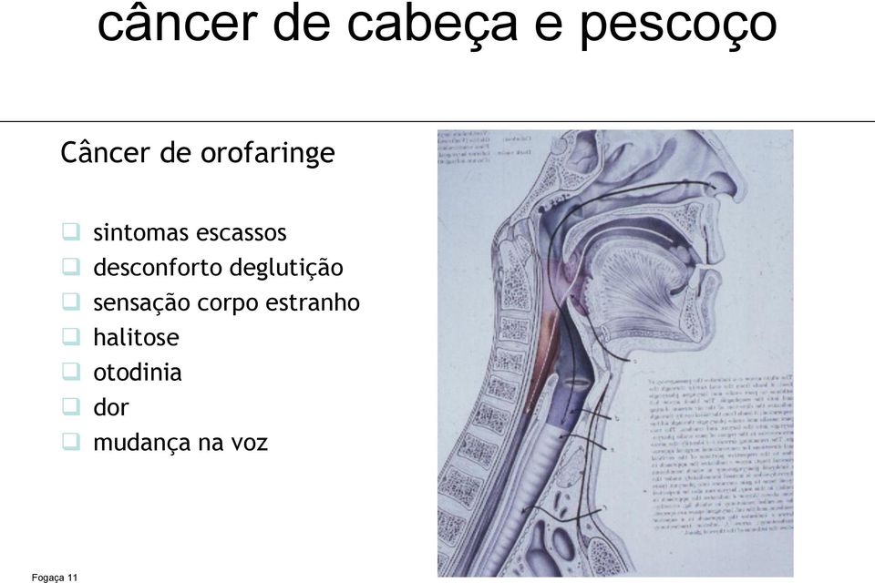 sensação corpo estranho halitose