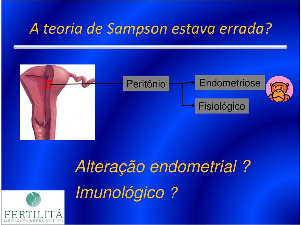 Peritônio Endometriose