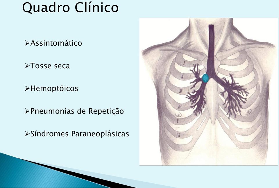 Hemoptóicos Pneumonias de