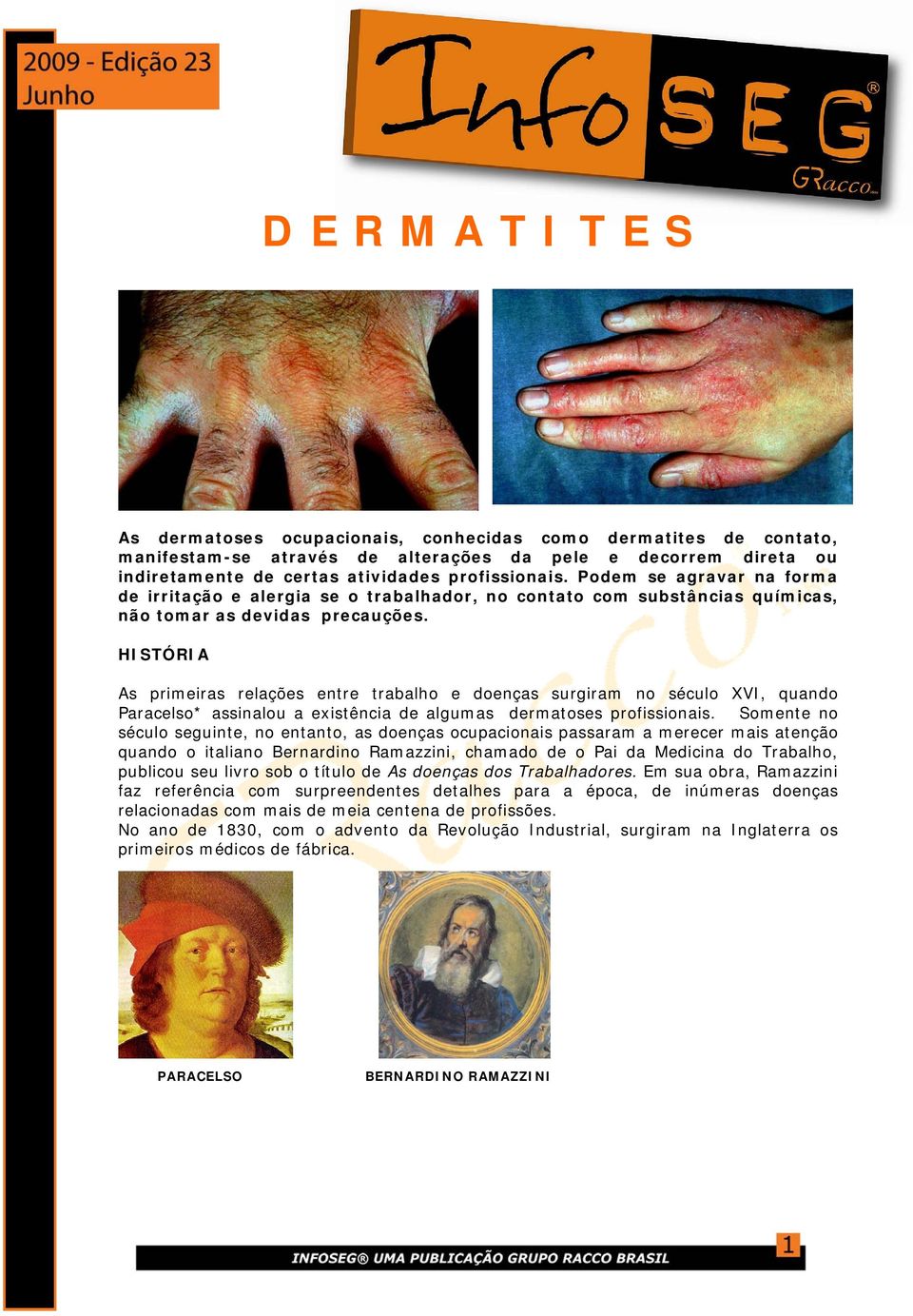 HISTÓRIA As primeiras relações entre trabalho e doenças surgiram no século XVI, quando Paracelso* assinalou a existência de algumas dermatoses profissionais.