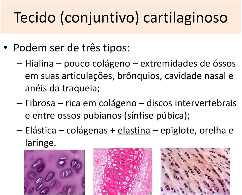 e anéis da traqueia; Fibrosa rica em colágeno discos intervertebrais e entre