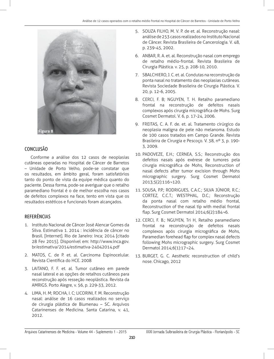 Revista Sociedade Brasileira de Cirurgia Plástica. V. 20, p. 12-6, 2005. 8. CERCI, F. B; NGUYEN, T. H.