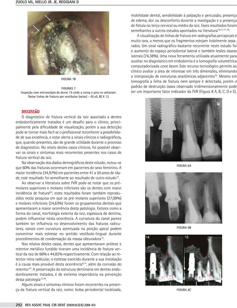 fistula no terço cervical ou médio da raiz. Esses resultados foram semelhantes a outros estudos apontados na literatura 7,9,11,17-18.