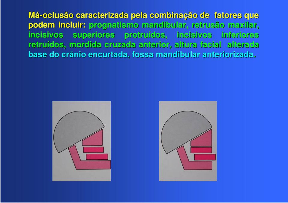 dos,, incisivos inferiores retruídos dos,, mordida cruzada anterior,