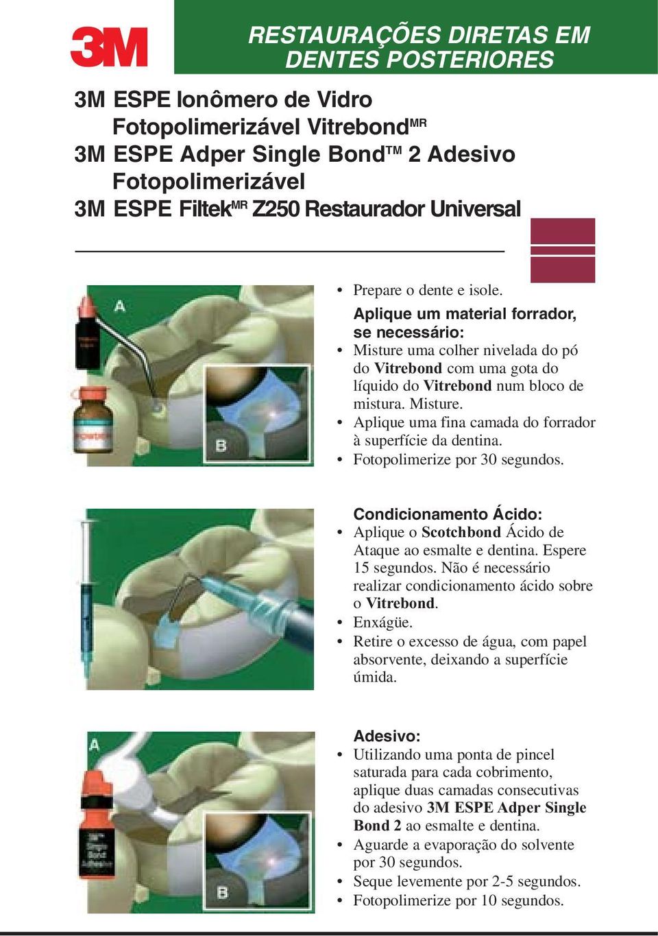 Fotopolimerize por 30 segundos. Condicionamento Ácido: Aplique o Scotchbond Ácido de Ataque ao esmalte e dentina. Espere 15 segundos. Não é necessário realizar condicionamento ácido sobre o Vitrebond.