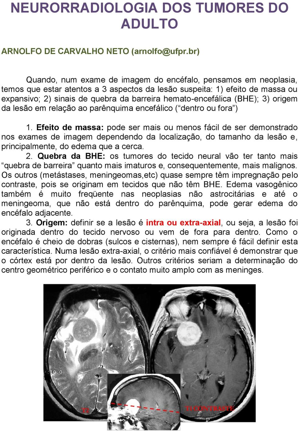 hemato-encefálica (BHE); 3) origem da lesão em relação ao parênquima encefálico ( dentro ou fora ) 1.
