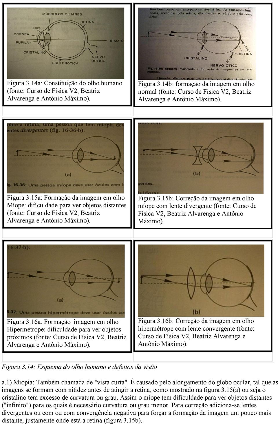 15a: Formação da imagem em olho Míope: dificuldade para ver objetos distantes (fonte: Curso de Física V2, Beatriz Alvarenga e Antônio Máximo). Figura 3.