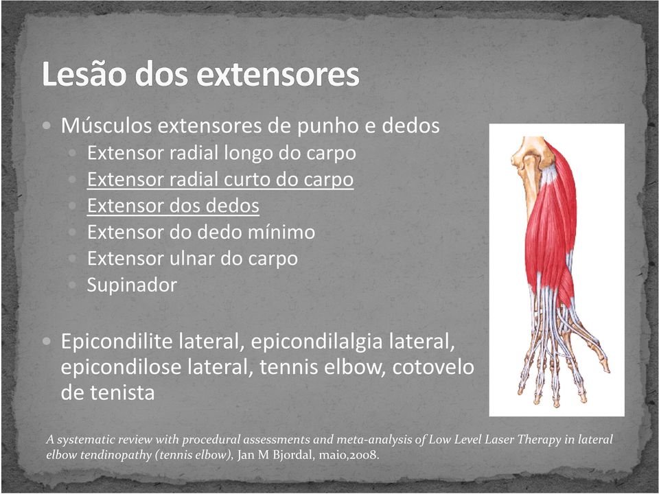 epicondilalgialateral, epicondiloselateral, tenniselbow, cotovelo de tenista A systematic review with