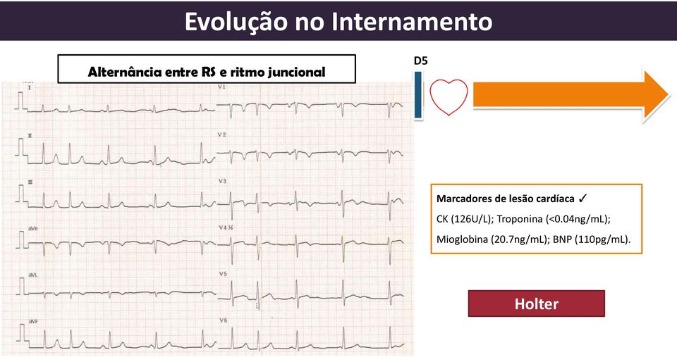 cardíaca CK (126U/L); Troponina (<0.
