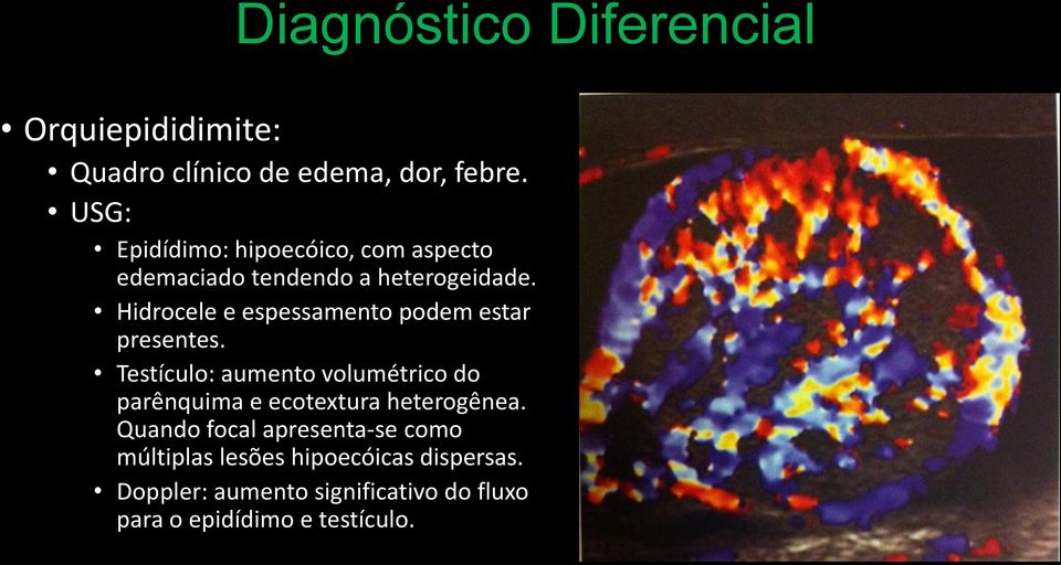 Hidrocele e espessamento podem estar presentes.