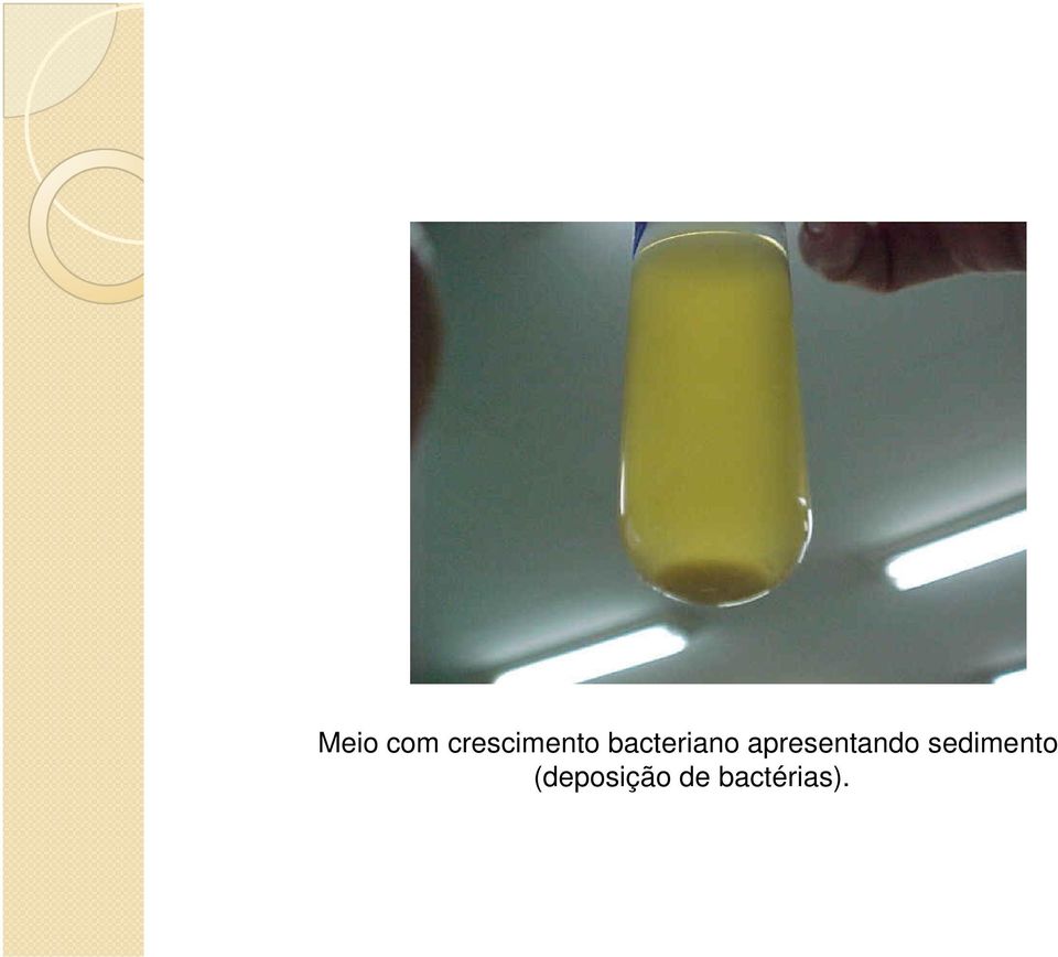 bacteriano