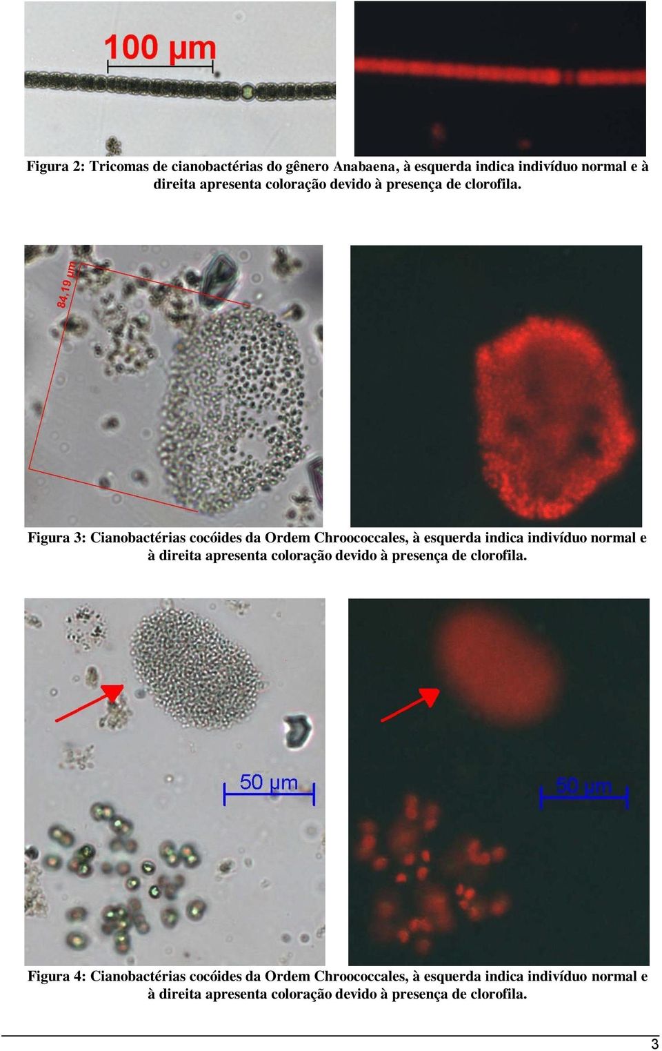 Figura 3: Cianobactérias cocóides da Ordem Chroococcales, à esquerda indica indivíduo normal e à direita apresenta 