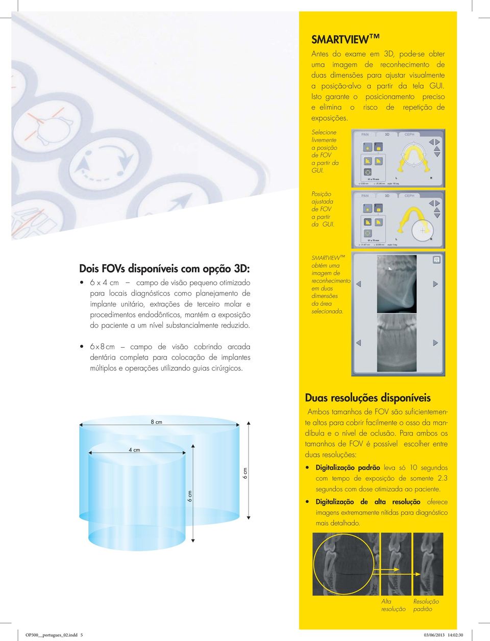 Dois FOVs disponíveis com opção 3D: 6 x 4 cm campo de visão pequeno otimizado para locais diagnósticos como planejamento de implante unitário, extrações de terceiro molar e procedimentos