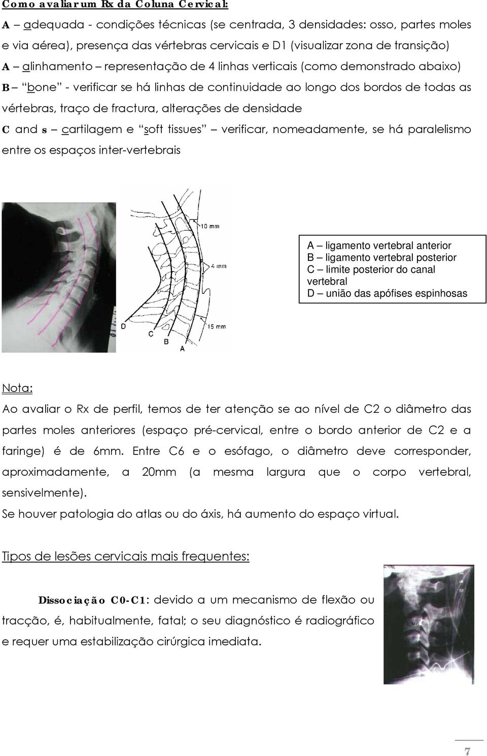 alterações de densidade C and s cartilagem e soft tissues verificar, nomeadamente, se há paralelismo entre os espaços inter-vertebrais A ligamento vertebral anterior B ligamento vertebral posterior C