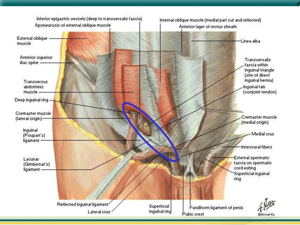 Estende-se do anel inguinal profundo até o externo; Contêm Cordão inguinal ou lig redondo