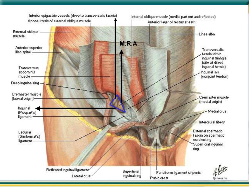 canal inguinal; Borda súpero-lateral: vasos