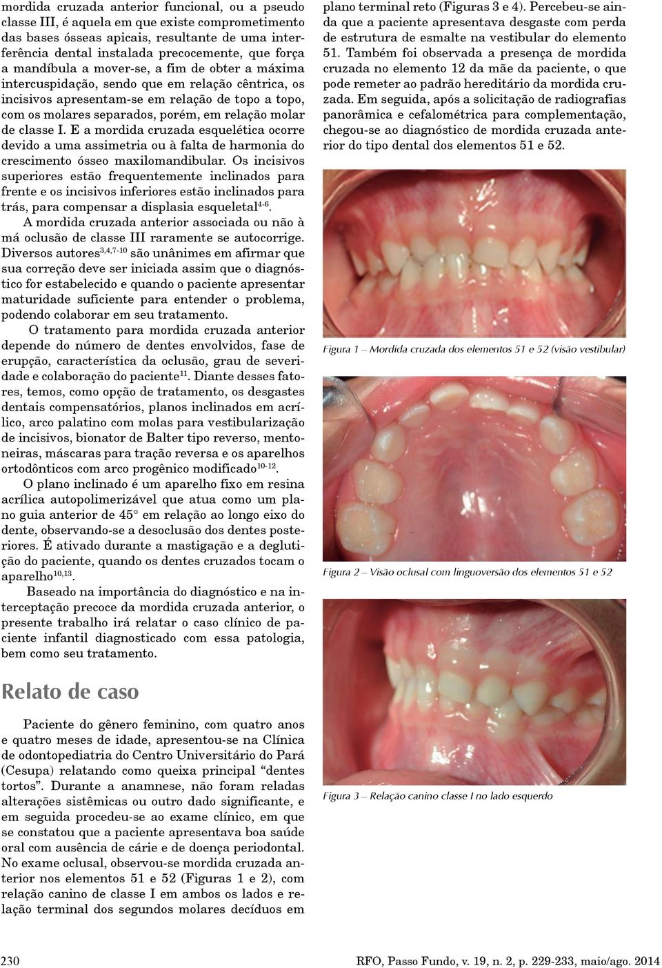 de classe I. E a mordida cruzada esquelética ocorre devido a uma assimetria ou à falta de harmonia do crescimento ósseo maxilomandibular.