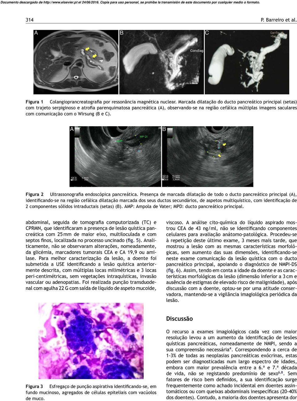 com o Wirsung (B e C). Figura 2 Ultrassonografia endoscópica pancreática.