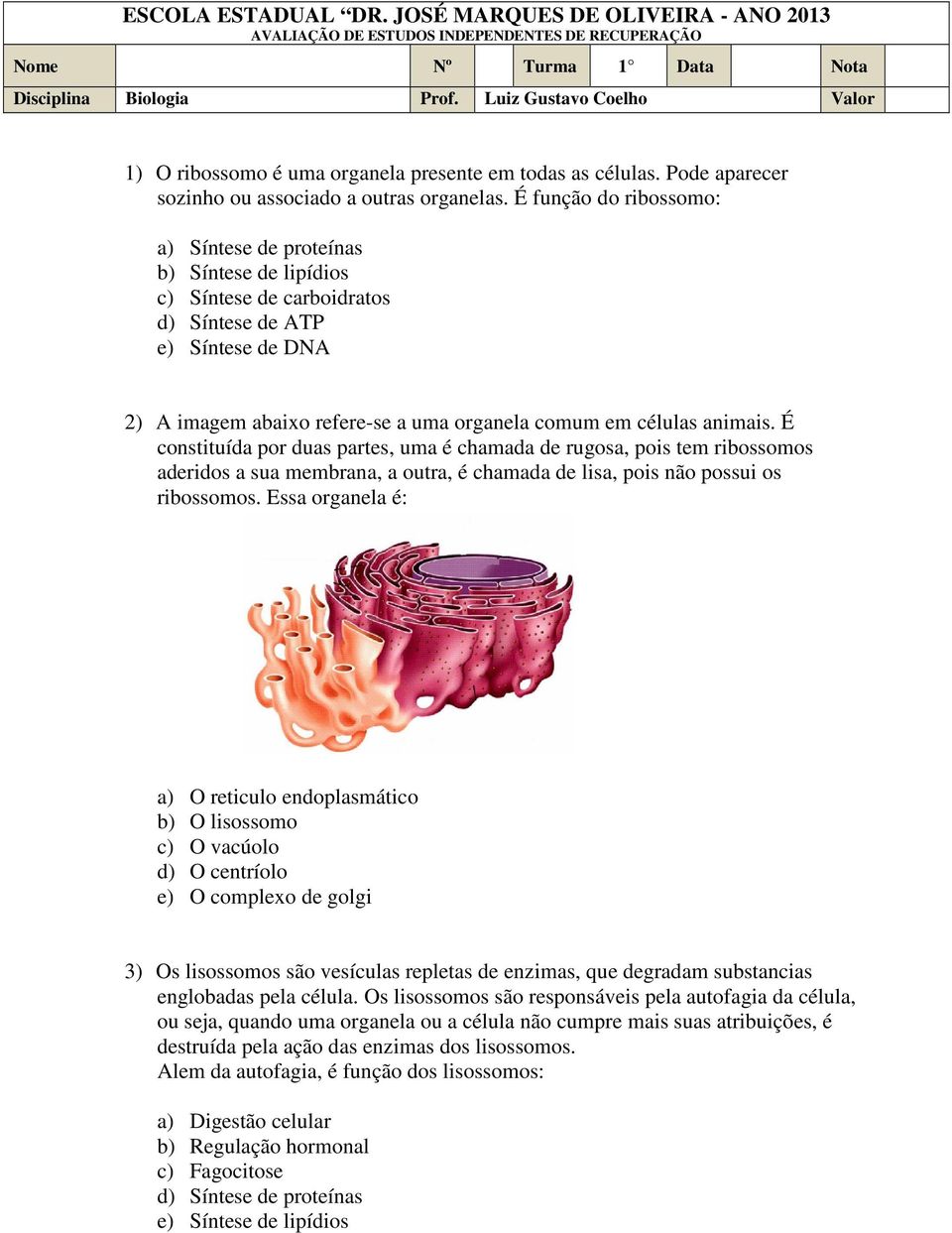 É função do ribossomo: a) Síntese de proteínas b) Síntese de lipídios c) Síntese de carboidratos d) Síntese de ATP e) Síntese de DNA 2) A imagem abaixo refere-se a uma organela comum em células