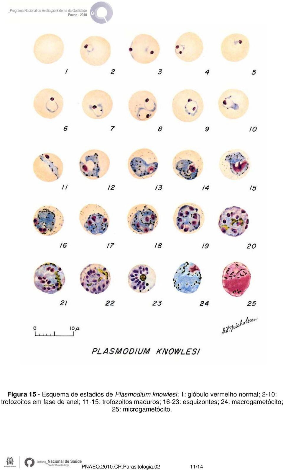 11-15: trofozoitos maduros; 16-23: esquizontes; 24:
