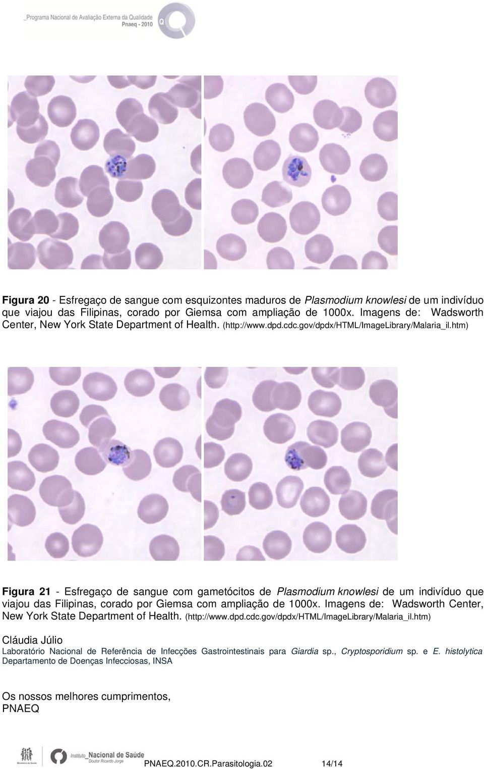 htm) Figura 21 - Esfregaço de sangue com gametócitos de Plasmodium knowlesi de um indivíduo que viajou das Filipinas, corado por Giemsa com ampliação de 1000x.