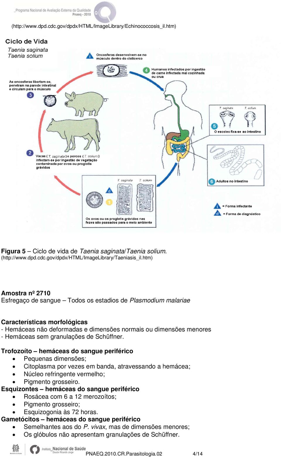 granulações de Schüffner. Trofozoíto hemáceas do sangue periférico Pequenas dimensões; Citoplasma por vezes em banda, atravessando a hemácea; Núcleo refringente vermelho; Pigmento grosseiro.