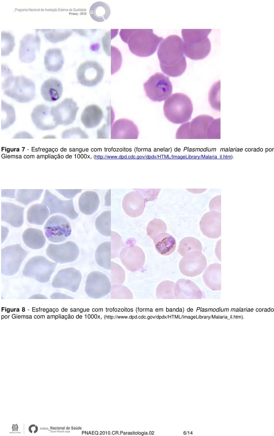 Figura 8 - Esfregaço de sangue com trofozoitos (forma em banda) de Plasmodium malariae corado por Giemsa