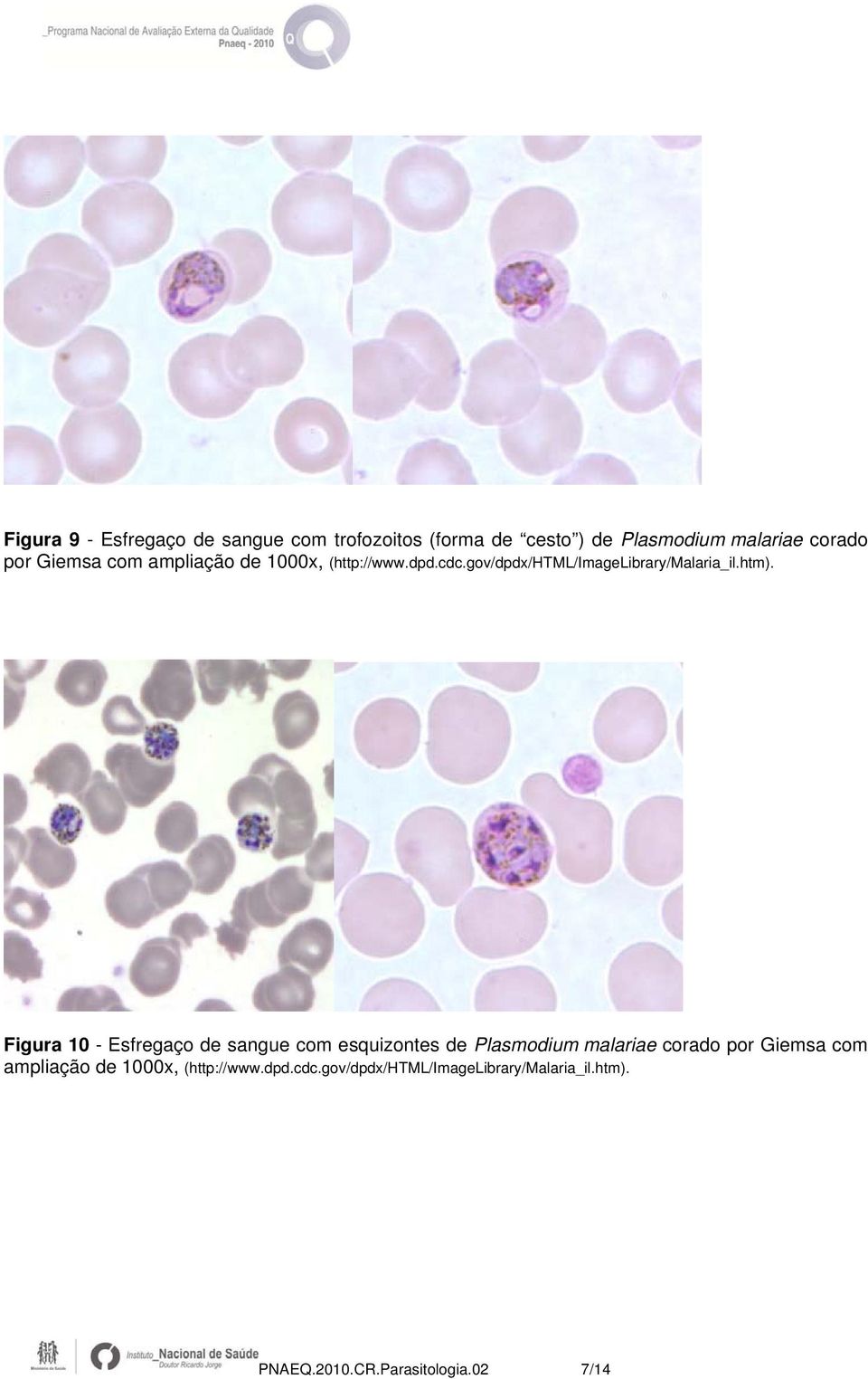 Figura 10 - Esfregaço de sangue com esquizontes de Plasmodium malariae corado por  PNAEQ.2010.CR.