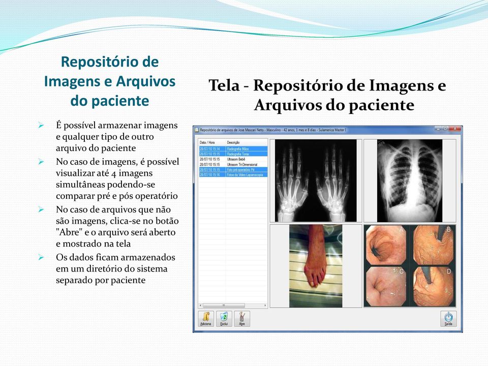 imagens simultâneas podendo-se comparar pré e pós operatório No caso de arquivos que não são imagens, clica-se no