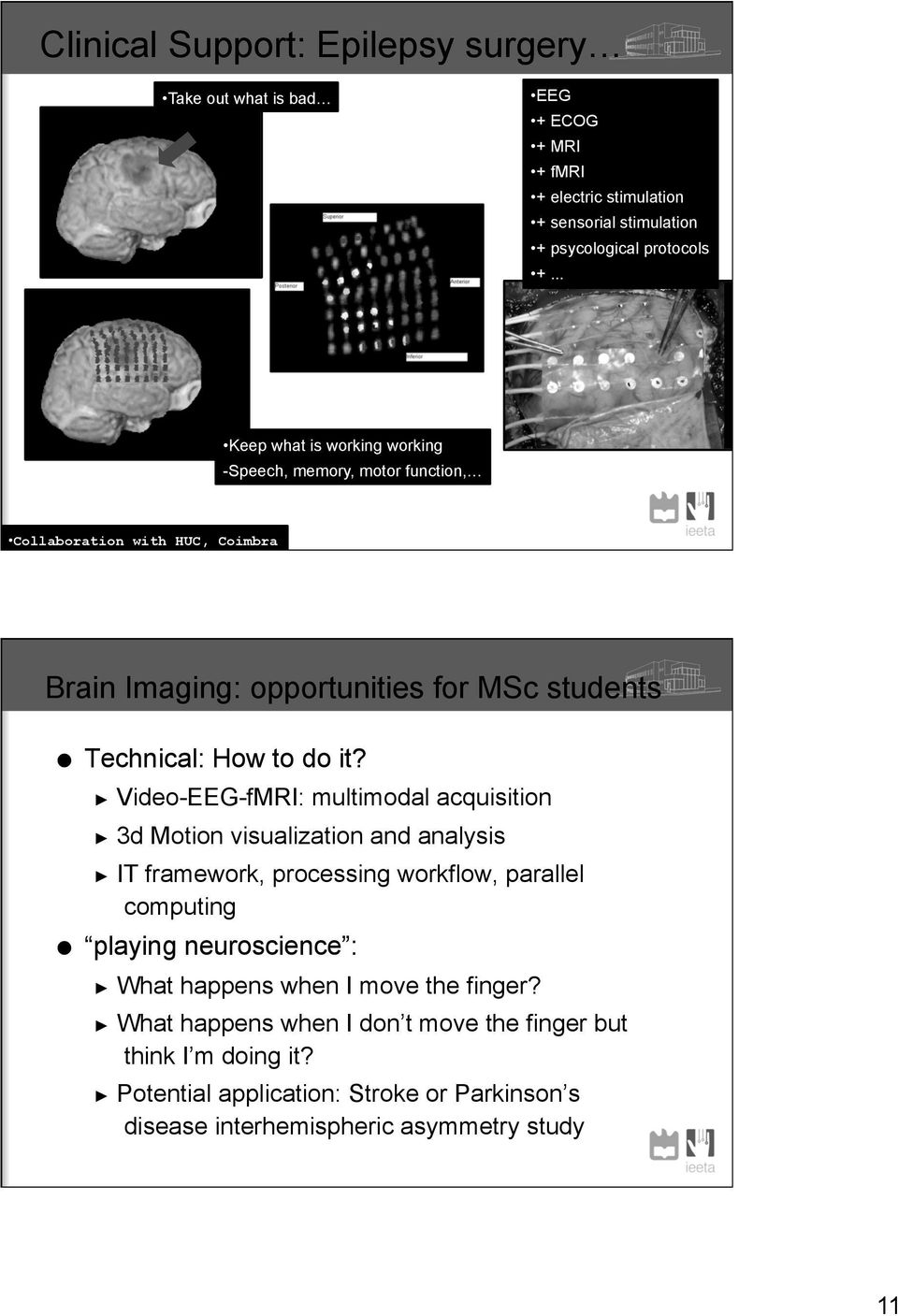 Video-EEG-fMRI: multimodal acquisition 3d Motion visualization and analysis IT framework, processing workflow, parallel computing playing neuroscience : What happens