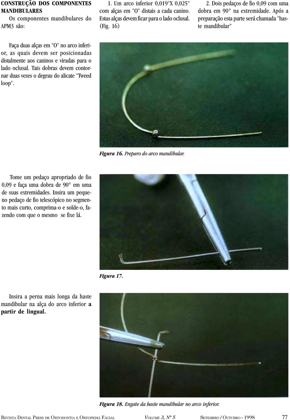 Após a preparação esta parte será chamada "haste mandibular" Faça duas alças em "O" no arco inferior, as quais devem ser posicionadas distalmente aos caninos e viradas para o lado oclusal.