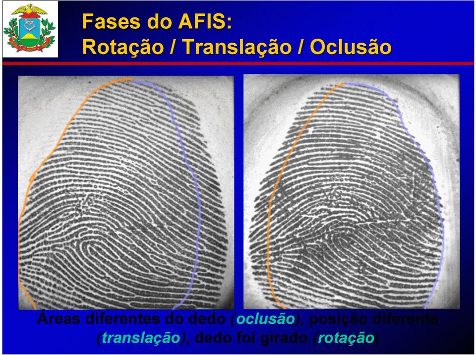 diferentes do dedo (oclusão),